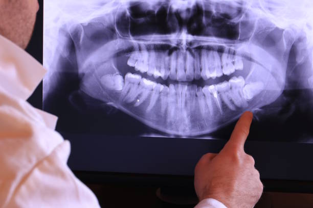 Best Dentist for Severe Toothache  in Chinchilla, PA