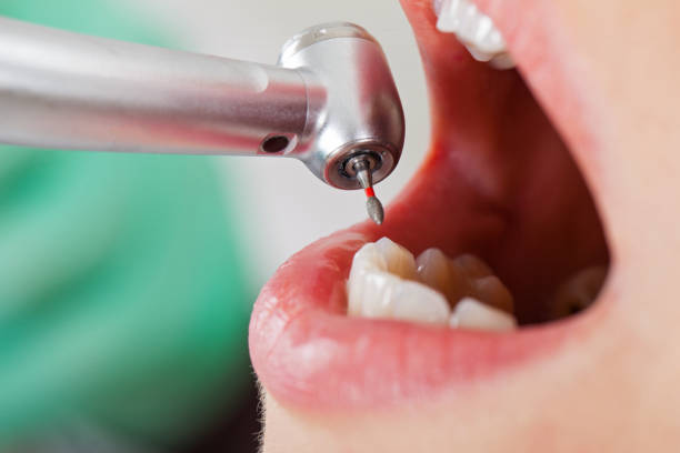 Best Knocked-Out Tooth Emergency  in Chinchilla, PA